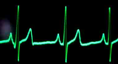 allenamento cardiaco